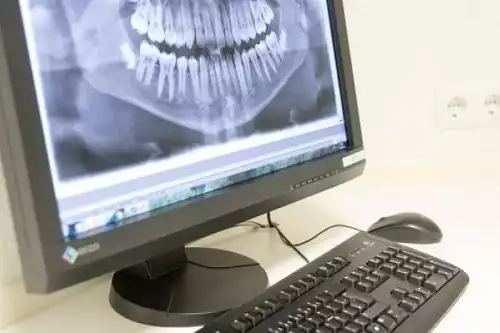 Ein Zahnröntgenbild wird am Computerbildschirm in einer Zahnarztpraxis angezeigt.